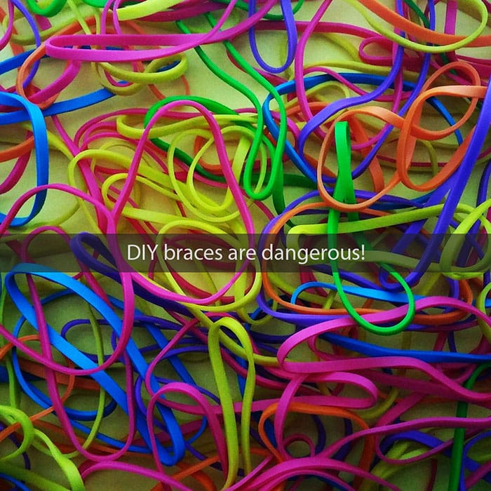 diy-braces